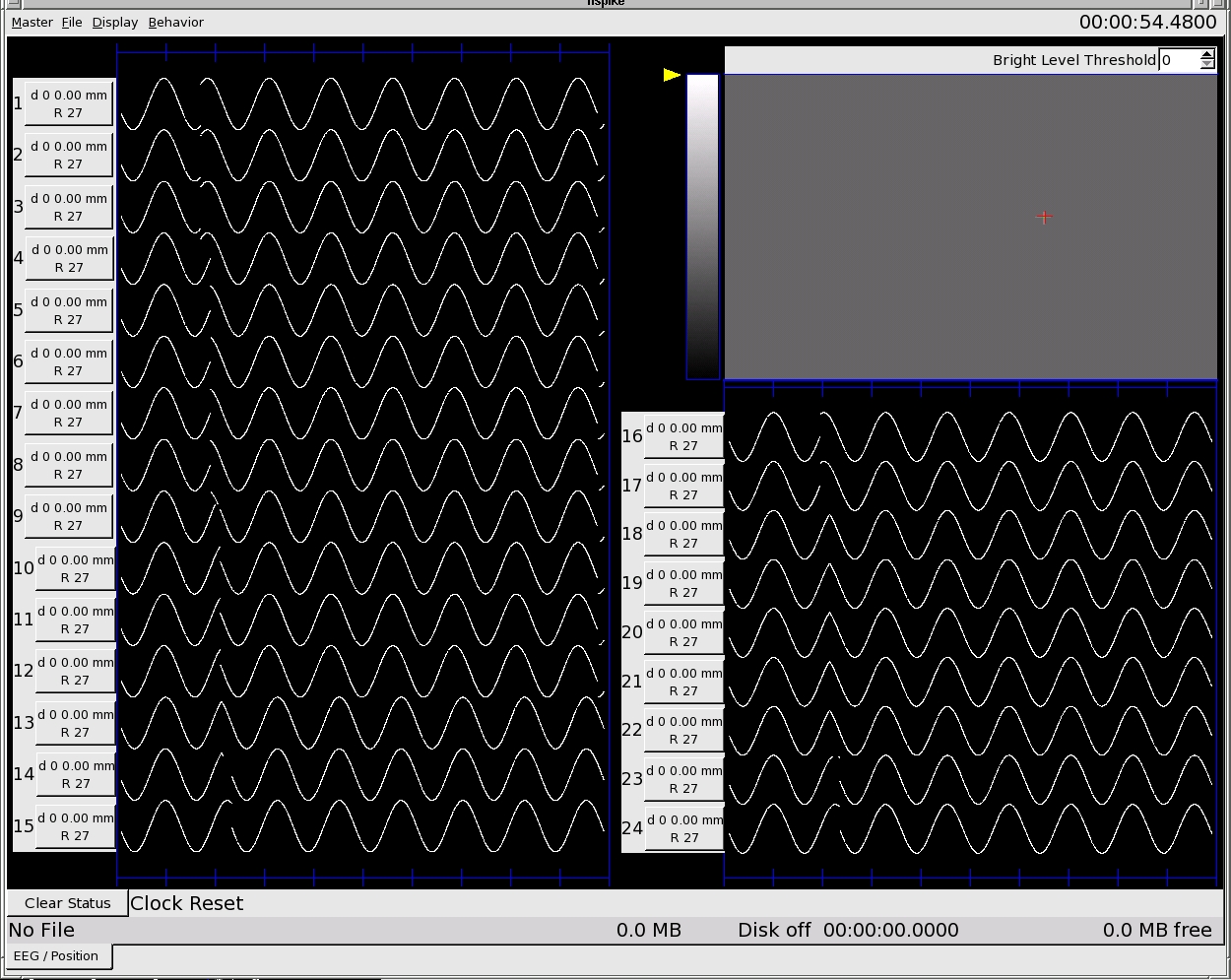 EEG Position Screen